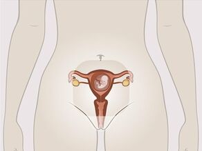 Zwangere vrouw rechtopstaand. De focus ligt op de inwendige geslachtsdelen met de baby in de baarmoeder.
