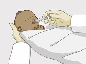 El bebé tiene que recibir medicamentos después del nacimiento.