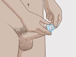Trykk tuppen på kondomet sammen slik at det blir plass til sæd, før du setter det på tuppen av penis.