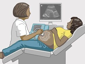 در هفته 17 تا 19 بارداری اسکن اولتراسوند انجام می شود.
