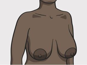Distintas formas de senos: senos grandes.