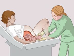 Usually, the baby is born naturally. 
