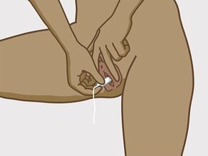 Vrouw spreidt haar schaamlippen om een tampon in haar vagina in te brengen. 