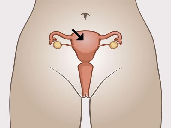 Woman's internal sexual organs with indication of the uterus