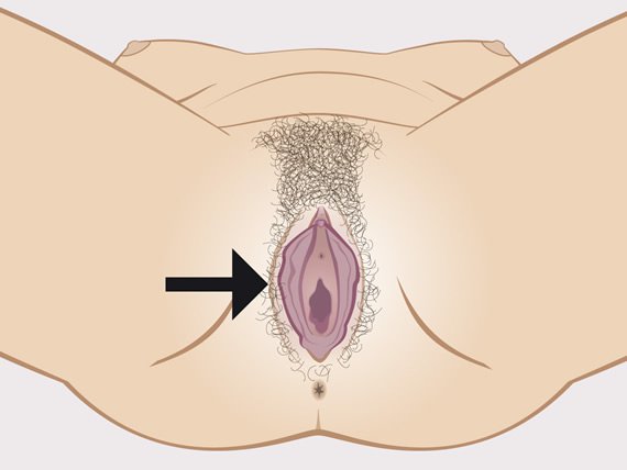 Oversikt over vulva