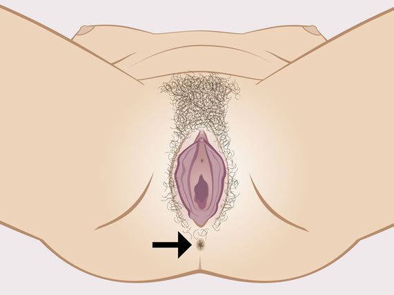 Kvinnens synlige kjønnsorganer samt anus